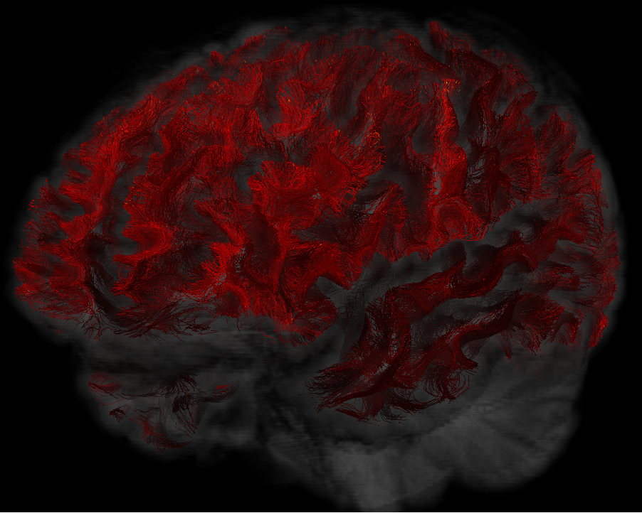 An MRI scan of brain from dimitri shashtin's research